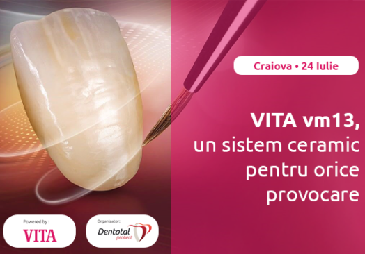 Vita vm13, un sistem ceramic pentru orice provocare – 24.07.2024,Craiova