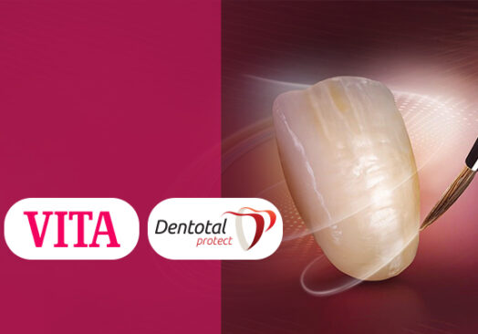 Stratificare pe zirconiu Hybrid – 10.09.2025, Craiova